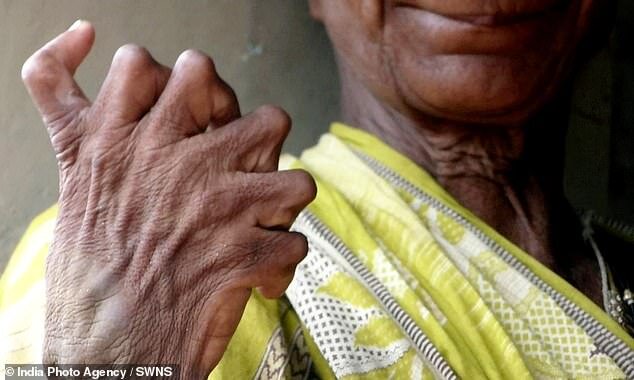 31 barmaqlı bu qadın cadugar elan edildi - FOTO-VİDEO