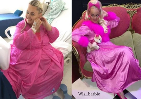 "Toppuş" "Barbie" utandığından 82 kilo ARIQLADI - FOTO-VİDEO