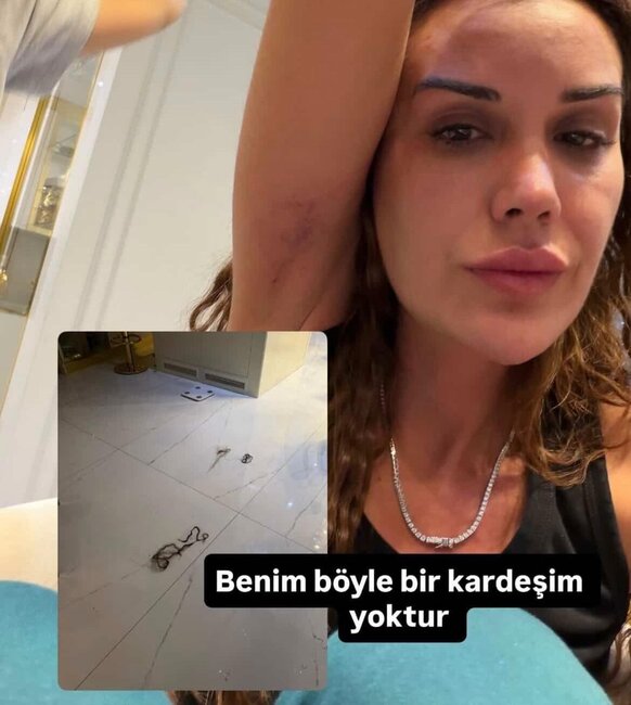 Bacısı Dilan Polatı döydü - Fotolar