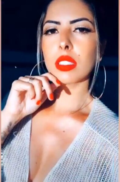 Çənə cərrahı ilə evləndikdən sonra halı görənləri şoka saldı - FOTO