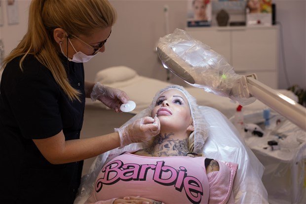 Özünü "Barbie"yə bənzətmək üçün 50 estetik əməliyyat keçirən qadının FOTOLARI