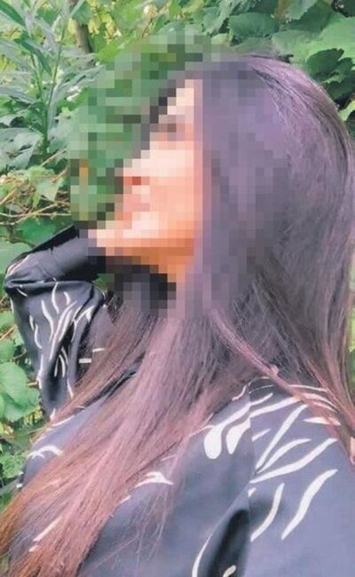Azərbaycanlı model sevgilisi tərəfindən döyüldü - FOTO