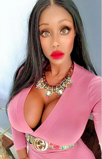 42 yaşlı "AfroBarbie" sinəsini və dodaqlarını "ŞİŞİRTDİ" - FOTOLAR