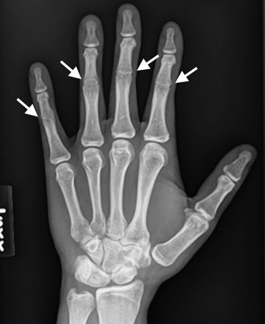 Bu adamın əlində orta oynaqlar YOXDUR - FOTO