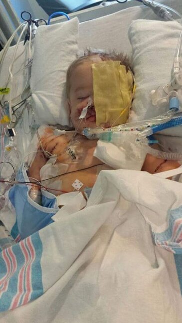 İt uşağı qapıb BU HALA saldı - Uşaqlar 