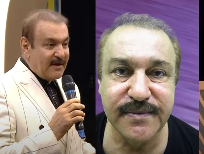 Cavanşir Məmmədov estetik etdirdi