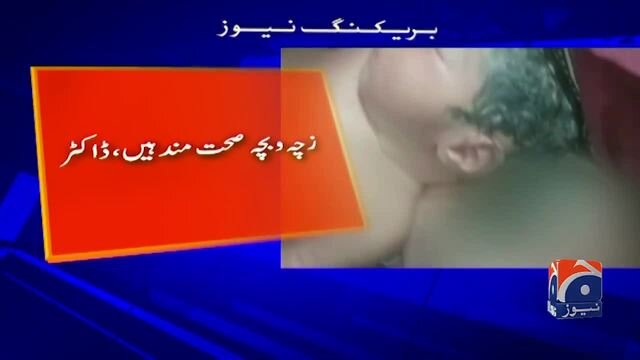 Yeni doğulan bu körpənin bir beyni İKİ BAŞI var - FOTO