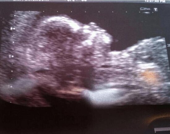 BAKİRƏ olan qadın HAMİLƏ QALDI - Yeni "Məryəm ana" dan ŞOK ETİRAF - FOTO