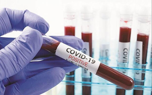 Daha 329 nəfərdə koronavirus aşkarlandı - 7 pasiyent öldü