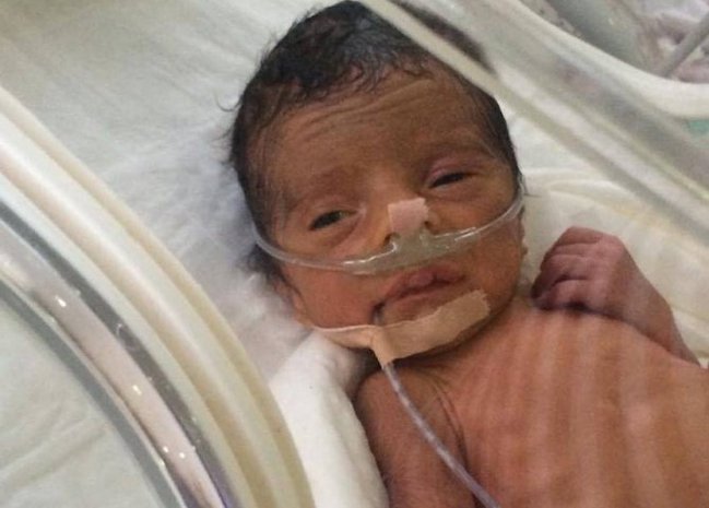 Azərbaycanda həkim səhlənkarlığı 6 aylıq körpəni canından etdi - VİDEO+FOTOLAR