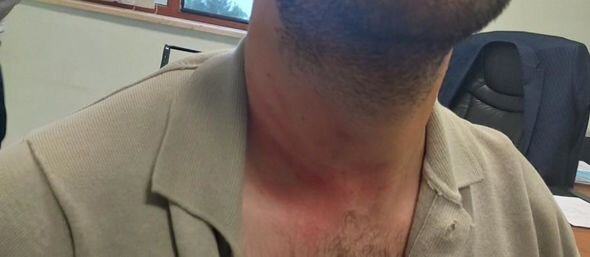 72 yaşlı kişi, oğlu və yeznəsi Füzulidə xəstəxananın vəzifəli əməkdaşını döydülər - FOTO