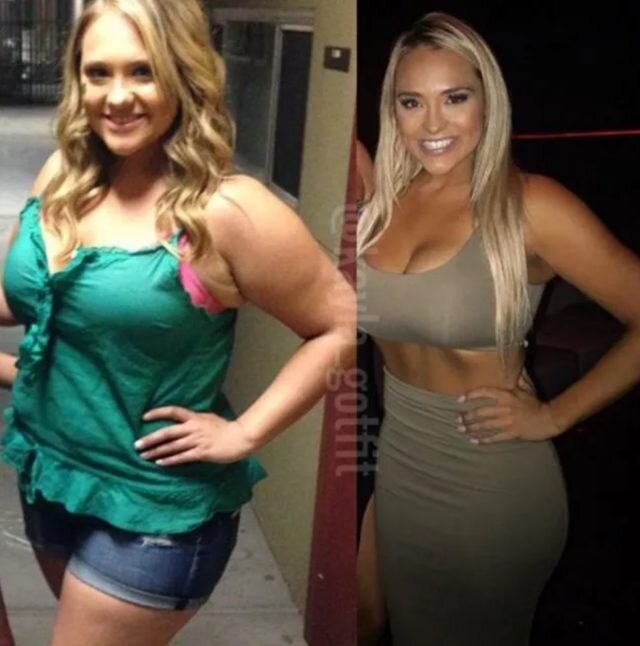 Artıq çəkisindən xilas olan qadın bu hala DÜŞDÜ - FOTOLAR