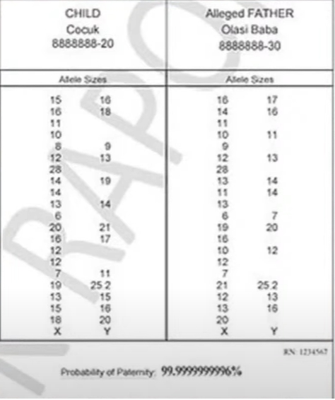 Doğuşun DNT analizinin nəticəsi açıqlandı - FOTO