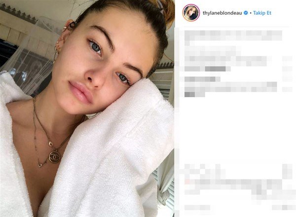 Dünyanın ən gözəl qızı idi, indiki halı təəccübləndirdi - FOTOLAR