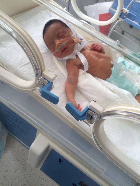 Azərbaycanda həkim səhlənkarlığı 6 aylıq körpəni canından etdi - VİDEO+FOTOLAR