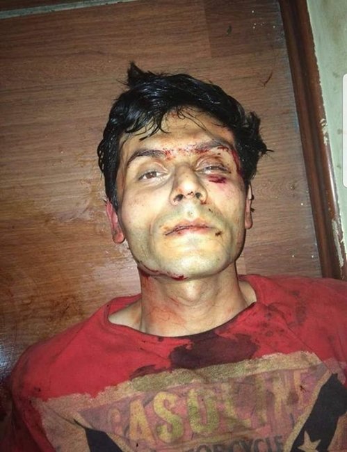 İcra başçısını güllələyən Yunisin ŞOK fotosu yayıldı - RƏSMİ AÇIQLAMA