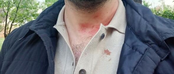 72 yaşlı kişi, oğlu və yeznəsi Füzulidə xəstəxananın vəzifəli əməkdaşını döydülər - FOTO