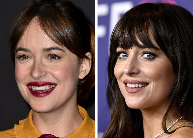 Dişlərini düzəltdirib BELƏ OLDULAR - FOTOLAR