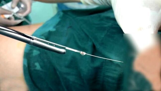 12 yaşlı uşağın gecə dərs etmək istədiyi üçün etdiyi hərəkət ŞOK ETDİ- cinsiyyət orqanına.. - FOTO