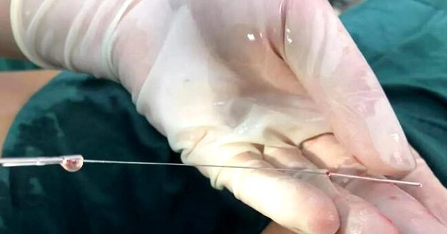 12 yaşlı uşağın gecə dərs etmək istədiyi üçün etdiyi hərəkət ŞOK ETDİ- cinsiyyət orqanına.. - FOTO