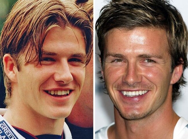 Dişlərini düzəltdirib BELƏ OLDULAR - FOTOLAR