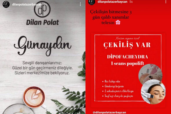 "Dilan Polat" gözəllik mərkəzinin Azərbaycan şöbəsi bağlanacaq? - RƏSMİ CAVAB + FOTO