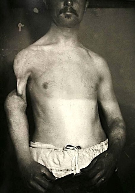 Başındakı buynuzla gəzən qadının fotoları görənləri dəhşətə gətirir