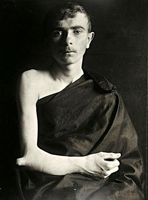 Başındakı buynuzla gəzən qadının fotoları görənləri dəhşətə gətirir