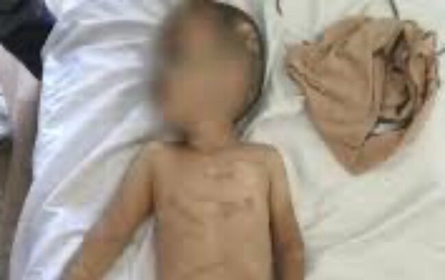 Döyülən uşaqların vəziyyəti - Açıqlandı