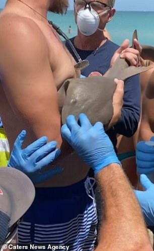 Qolunu köpəkbalığı dişləyən adam deyib-gülərək xəstəxanaya getdi - FOTO-VİDEO