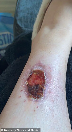 3 ay solariuma getdi, ayağındakı kiçik xal BU HALA DÜŞDÜ - DƏHŞƏTLİ FOTOLAR