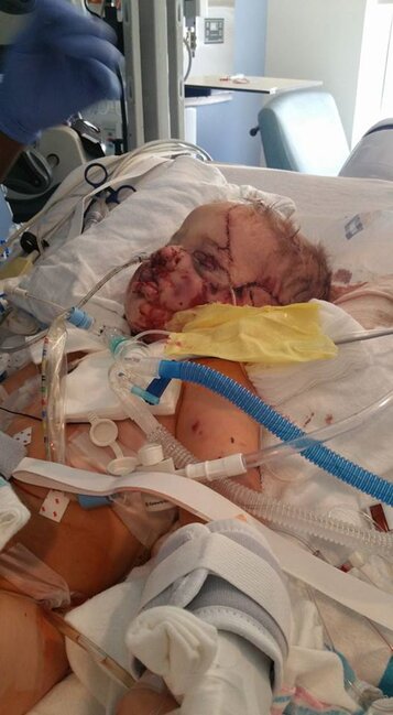 İt uşağı qapıb BU HALA saldı - Uşaqlar 