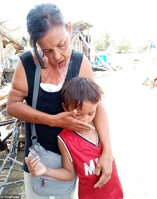 Görülməmiş hadisə! 15 ildir bu vəziyyətdə yaşayır - FOTOLAR