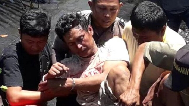 Ər arvadını dişləyərək öldürdü - FOTO