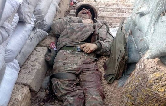 114 ölü, 140 yaralı – Ermənistan Müdafiə Nazirliyinin rəsmi STATİSTİKASI