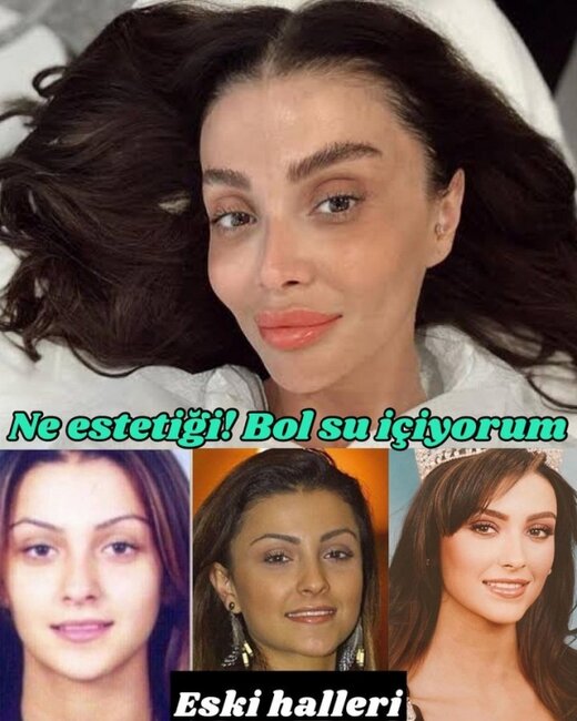 Estetik etdirmədiyini dedi, arxiv fotoları üzə çıxdı