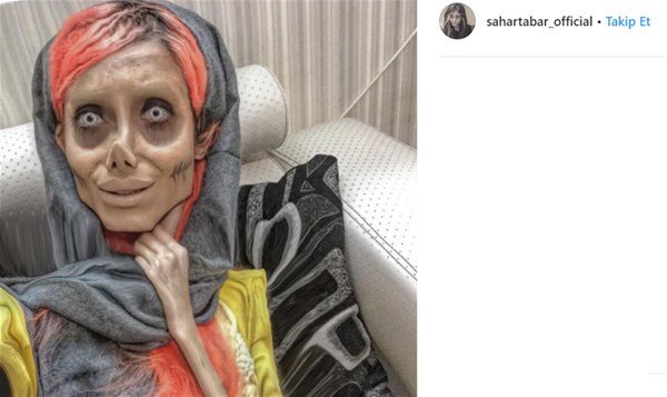 Coliye bənzəmək üçün onlarla əməliyyat etdirən fenomenin 10 il öncəki ŞOK HALI - FOTOLAR