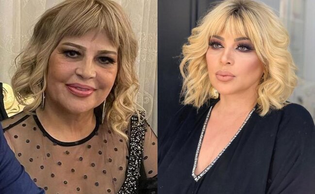 Mətanət İsgəndərlinin fotoşopsuz şəkli təəccübləndirdi