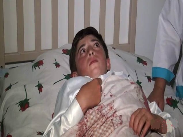 Ermənilərin yaraladığı 13 yaşlı Ramin GÖRÜN NƏLƏR DANIŞDI - VİDEO