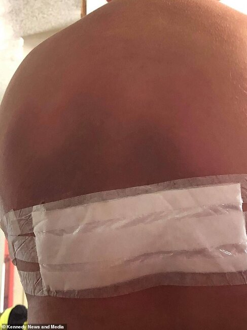 Telefonu şarja qoyub yuxuya gedən yeniyetmə BELƏ YANDI - FOTO+18