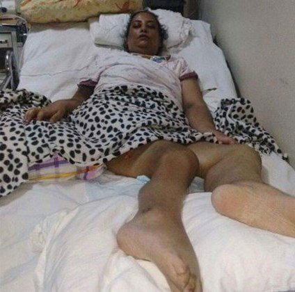 145 kq olduğu üçün əri boşadı, qadın çıxış yolu axtararkən ölümlə üzbəüz qaldı