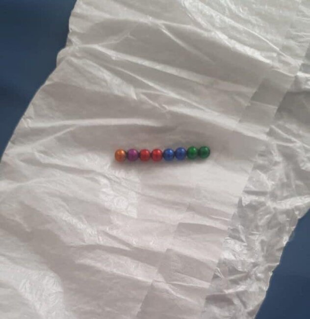 Azərbaycanda DƏHŞƏT: 1 yaşlı uşağın bağırsağından GÖRÜN NƏ ÇIXDI