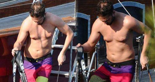 Murat Boz sinəsini kiçiltdi - FOTO