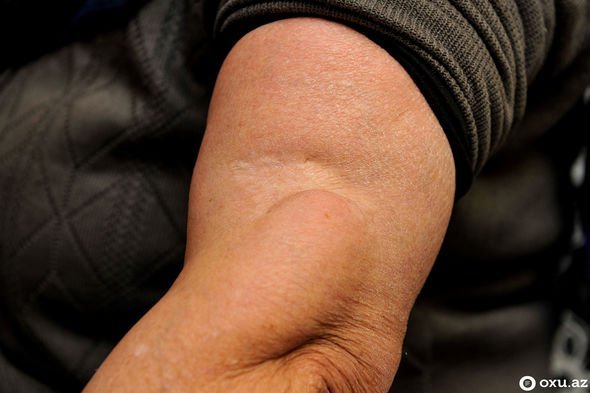 Səkkiz aylıq hamilə olan 20 yaşlı gəlini meşədə... - Xocalının izləri FOTOLARDA