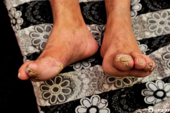 Səkkiz aylıq hamilə olan 20 yaşlı gəlini meşədə... - Xocalının izləri FOTOLARDA