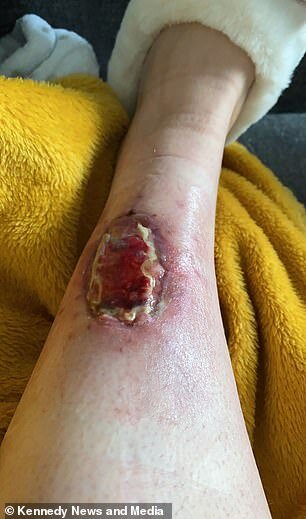 3 ay solariuma getdi, ayağındakı kiçik xal BU HALA DÜŞDÜ - DƏHŞƏTLİ FOTOLAR