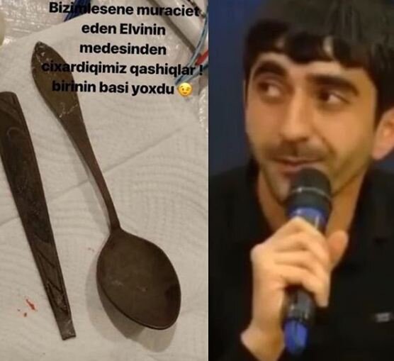 Azərbaycanda şok: Narkomaniyadan əziyyət çəkən Elvin qaşıq uddu - VİDEO