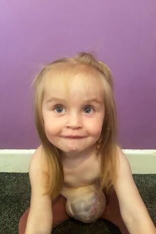 Bu qızın bağırsaqları anadangəlmə bayırdadır - FOTOLAR