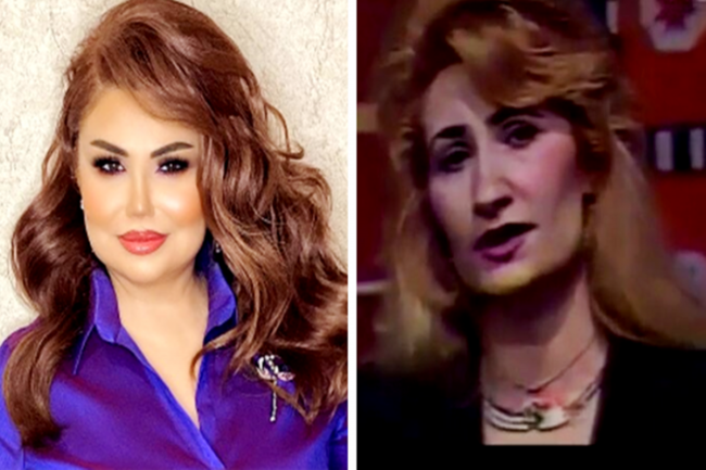 Şou-biznesdəki qadınların ƏVVƏLKİ və SONRAKI HALI - FOTOLAR