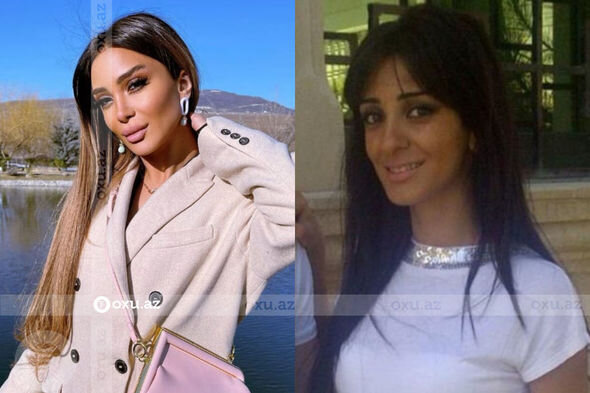 Gözəlliyi ilə diqqət çəkən azərbaycanlı məşhurların əməliyyatdan öncəki görüntüləri - FOTO